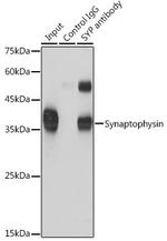 Synaptophysin Antibody in Immunoprecipitation (IP)