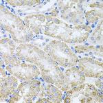 TARS Antibody in Immunohistochemistry (Paraffin) (IHC (P))