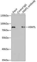 ASMTL Antibody in Immunoprecipitation (IP)