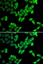 TRIP10 Antibody in Immunocytochemistry (ICC/IF)