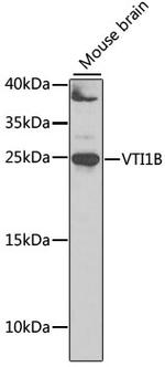 VTI1B Antibody in Western Blot (WB)