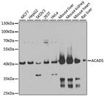 ACADS Antibody in Western Blot (WB)