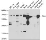 GNS Antibody in Western Blot (WB)