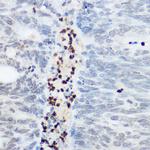 SHC Antibody in Immunohistochemistry (Paraffin) (IHC (P))