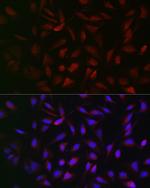 PFKP Antibody in Immunocytochemistry (ICC/IF)