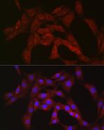 PFKP Antibody in Immunocytochemistry (ICC/IF)