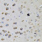 PFKP Antibody in Immunohistochemistry (Paraffin) (IHC (P))