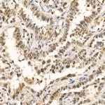 METTL3 Antibody in Immunohistochemistry (Paraffin) (IHC (P))