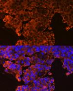 GHRHR Antibody in Immunocytochemistry (ICC/IF)