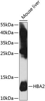 HBA2 Antibody in Western Blot (WB)