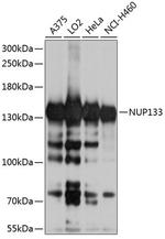 NUP133 Antibody in Western Blot (WB)