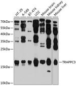 TRAPPC3 Antibody in Western Blot (WB)