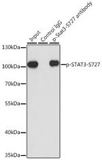 Phospho-STAT3 (Ser727) Antibody in Immunoprecipitation (IP)