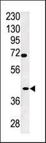 TPST2 Antibody in Western Blot (WB)