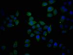 Epiregulin Antibody in Immunocytochemistry (ICC/IF)