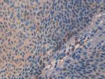 SLIT3 Antibody in Immunohistochemistry (Paraffin) (IHC (P))