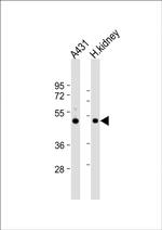 ZMPSTE24 Antibody in Western Blot (WB)