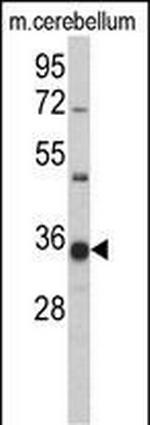 GGPS1 Antibody in Western Blot (WB)