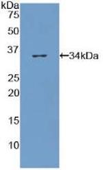 COL7A1 Antibody in Western Blot (WB)