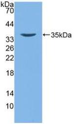 beta-2 Defensin Antibody in Western Blot (WB)