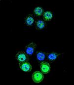 AKR1B1 Antibody in Immunocytochemistry (ICC/IF)