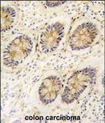 AKR1B1 Antibody in Immunohistochemistry (Paraffin) (IHC (P))