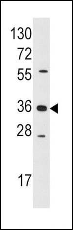 AKR1B1 Antibody in Western Blot (WB)