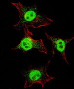 CD49f Antibody in Immunocytochemistry (ICC/IF)