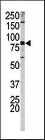 Phospho-Amyloid Precursor Protein (Ser730) Antibody in Western Blot (WB)