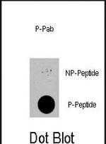 Phospho-PDPK1 (Ser396) Antibody in Dot Blot (DB)