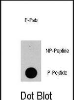 Phospho-PIK3CD (Tyr524) Antibody in Dot Blot (DB)