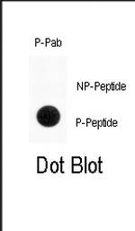 Phospho-ENT1 (Ser254) Antibody in Dot Blot (DB)