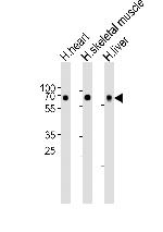 CRY2 Antibody in Western Blot (WB)