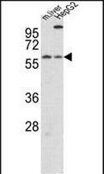 CRY2 Antibody in Western Blot (WB)