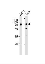 Septin-9 Antibody in Western Blot (WB)