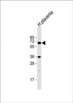 IL1R1 Antibody in Western Blot (WB)