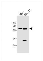 IL1R1 Antibody in Western Blot (WB)