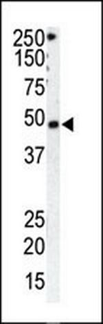 GRK1 Antibody in Western Blot (WB)