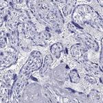 KIAA2012 Antibody in Immunohistochemistry (Paraffin) (IHC (P))