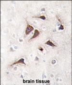 CaMKII delta Antibody in Immunohistochemistry (Paraffin) (IHC (P))