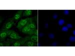 HDAC2 Antibody in Immunocytochemistry (ICC/IF)