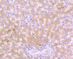 Cathepsin D Antibody in Immunohistochemistry (Paraffin) (IHC (P))