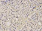 FGFR2 Antibody in Immunohistochemistry (Paraffin) (IHC (P))