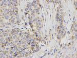 BCL-X Antibody in Immunohistochemistry (Paraffin) (IHC (P))