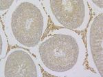 TRPV6 Antibody in Immunohistochemistry (Paraffin) (IHC (P))