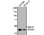 TRPV6 Antibody in Western Blot (WB)