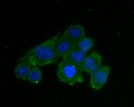 AKR1B1 Antibody in Immunocytochemistry (ICC/IF)