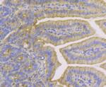 Cytokeratin 19 Antibody in Immunohistochemistry (Paraffin) (IHC (P))