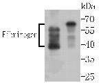 Fibrinogen Antibody in Western Blot (WB)