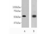 CD271 (NGF Receptor) Antibody in Western Blot (WB)